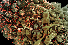 Příběh zvaný SARS-CoV-2